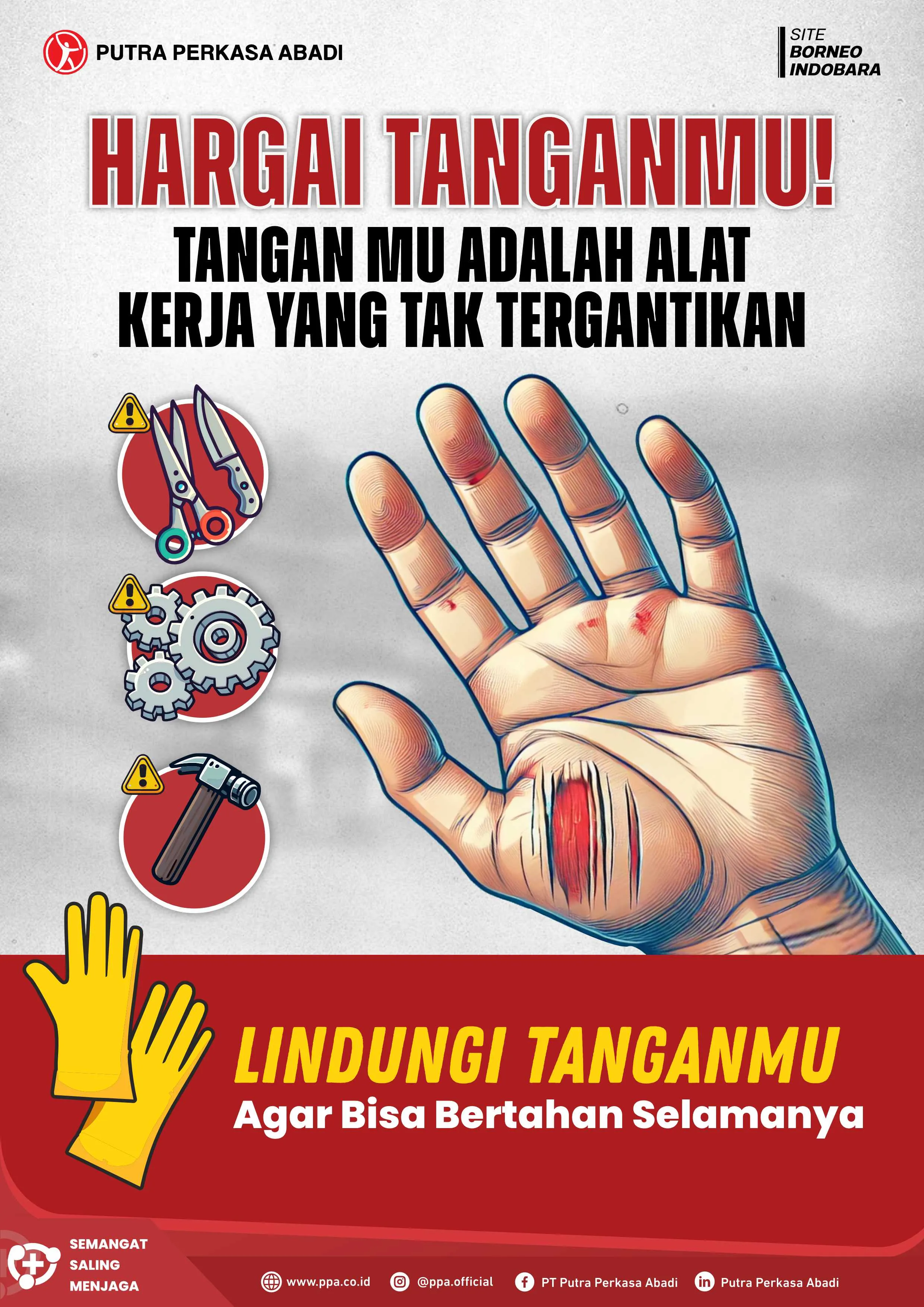 Hargai Tanganmu, Lindungi Aset Kerja yang Tak Tergantikan
